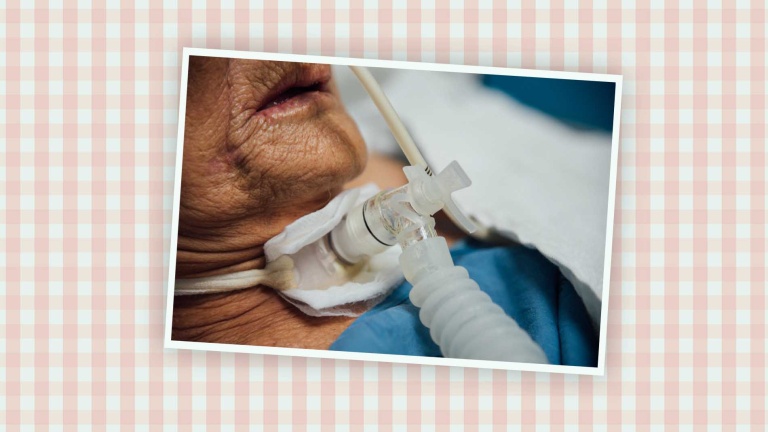 toos-beademing-stoma